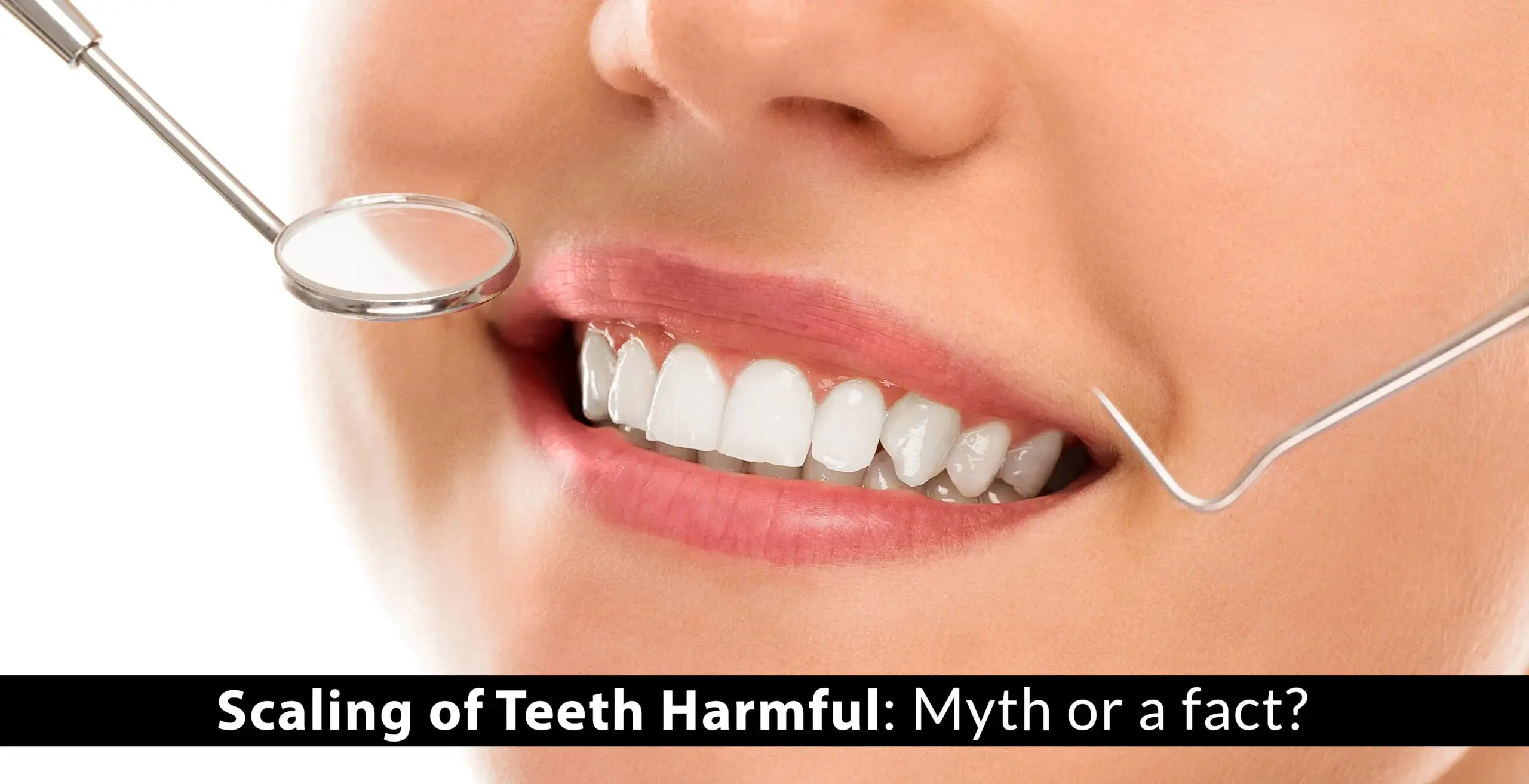 https://www.miracleshealth.com/assets/blog/assets/uploads/blog/Scaling of Teeth Harmful Myth or a fact