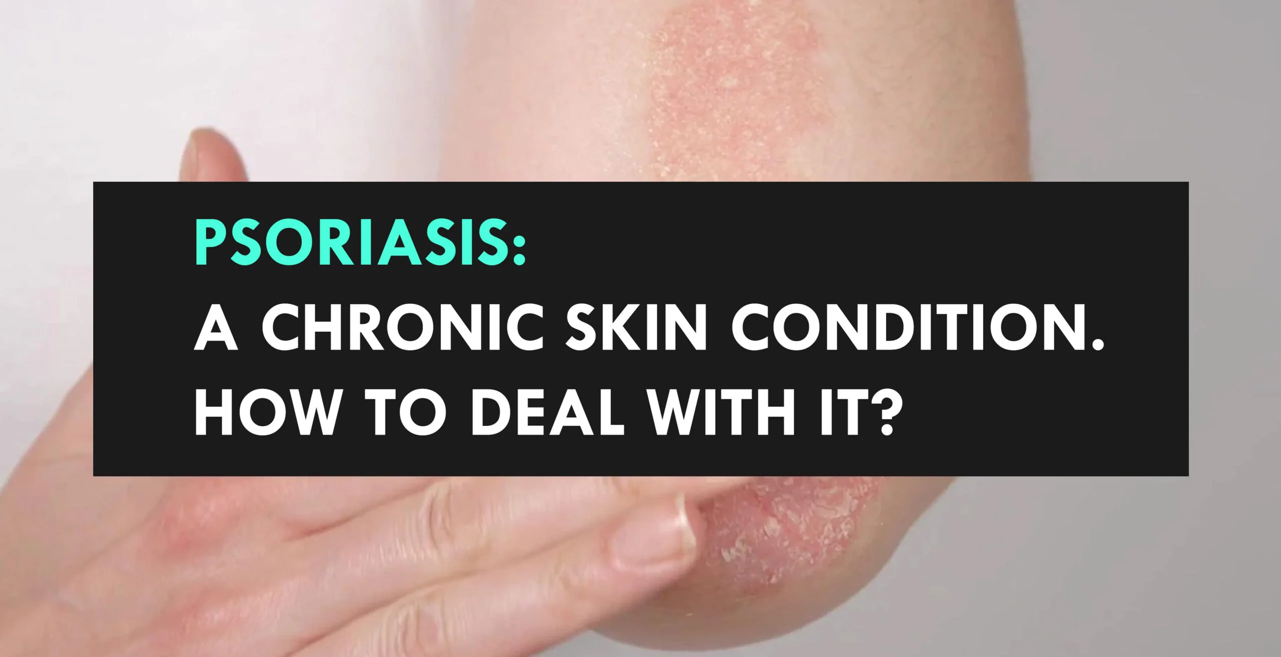 https://www.miracleshealth.com/assets/blog/assets/uploads/blog/Dermatology - Psoriasis A chronic skin condition