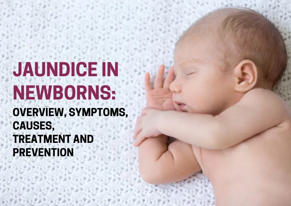 Jaundice in Newborns: Overview, Symptoms, Causes, Treatment and Prevention