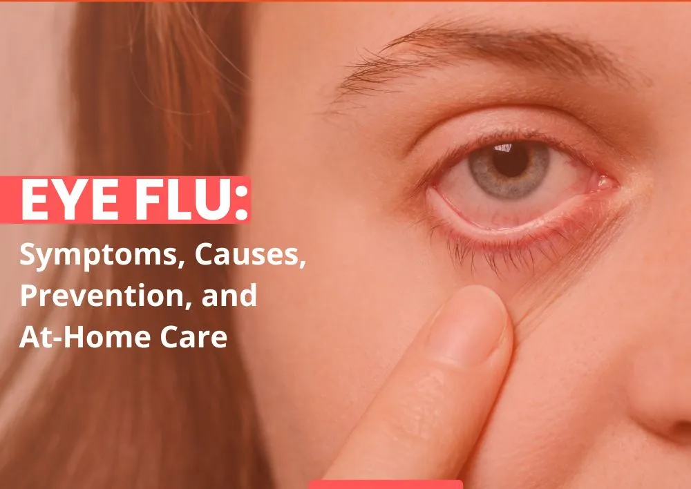 Eye Flu: Symptoms, Causes, Prevention, and At-Home Care