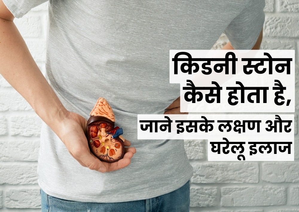 किडनी स्टोन कैसे होता है, जाने इसके लक्षण और घरेलू इलाज