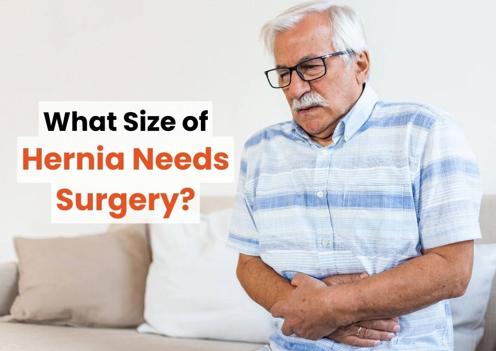 What Size of Hernia Needs Surgery?