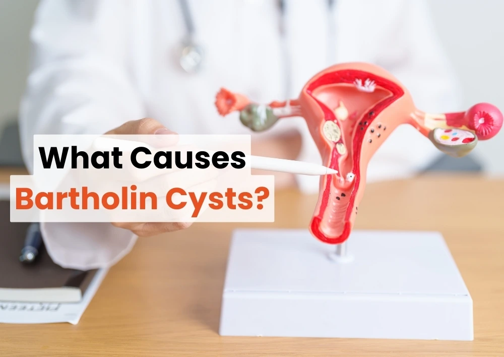 What Causes Bartholin Cysts?