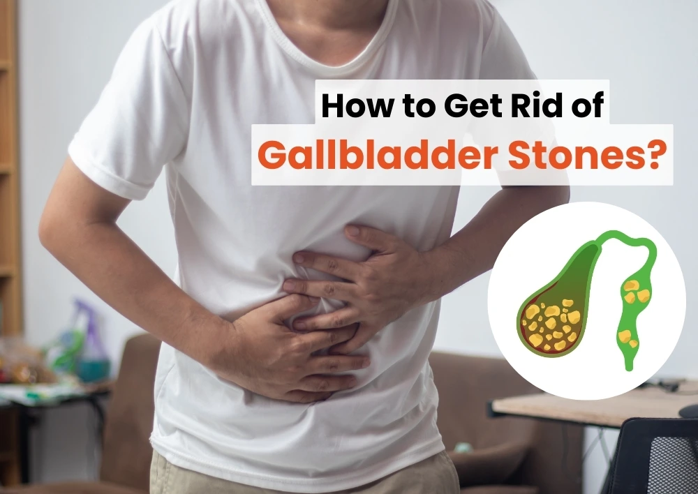 How to Get Rid of Gallbladder Stones?