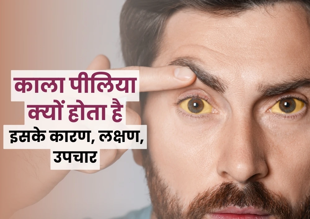 काला पीलिया क्यों होता है? इसके कारण, लक्षण, उपचार
