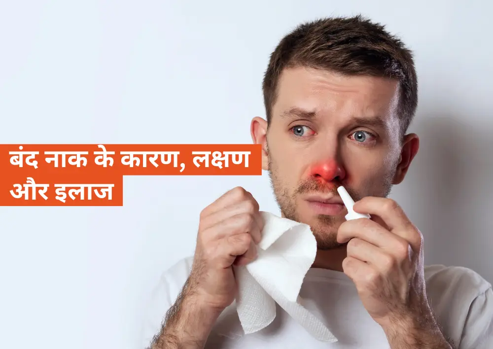 नाक बंद होने के कारण, लक्षण और उपचार