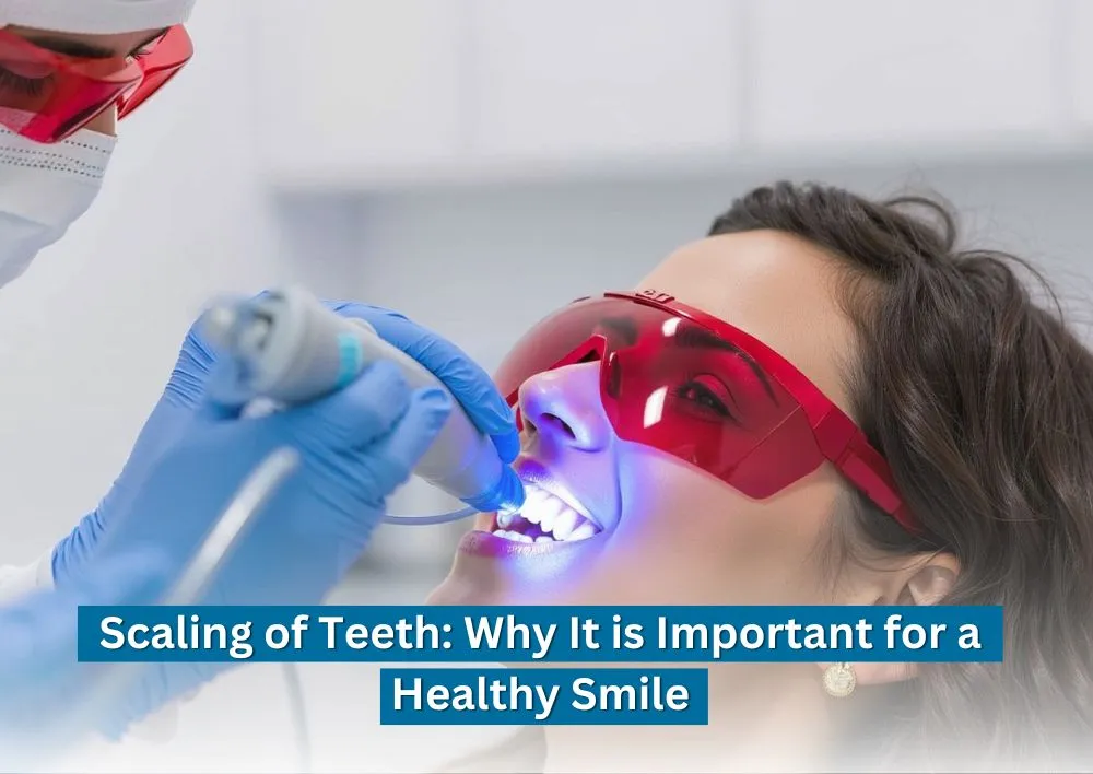 Scaling of Teeth: Why It is Important for a Healthy Smile