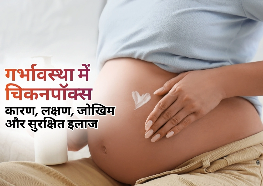 गर्भावस्था में चिकनपॉक्स: कारण, लक्षण, जोखिम और सुरक्षित इलाज