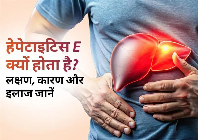 हेपेटाइटिस ई क्यों होता है: इसके लक्षण और उपचार