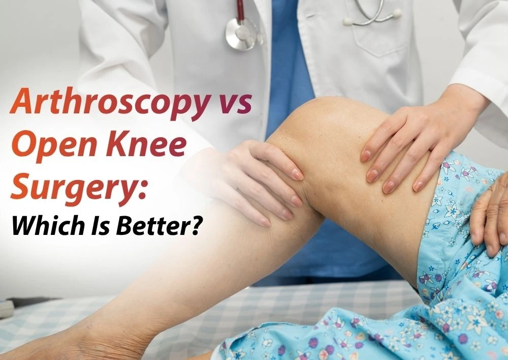 Arthroscopy vs Open Knee Surgery: Which Is Better?