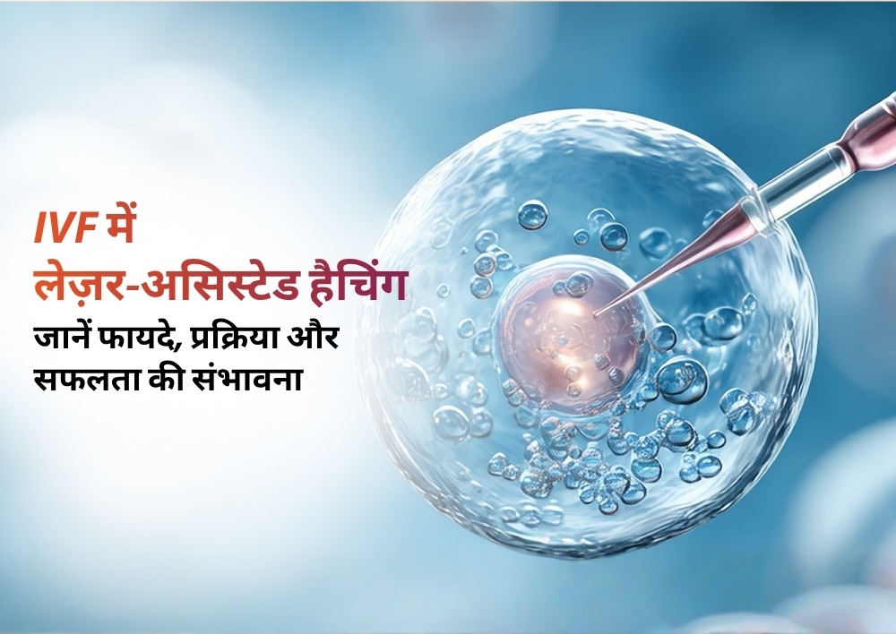 लेज़र हैचिंग से IVF सक्सेस रेट पर असर: क्या यह तकनीक बढ़ा सकती है गर्भधारण की संभावना