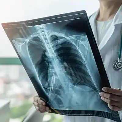 X-Ray