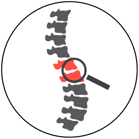 Spine Issues 