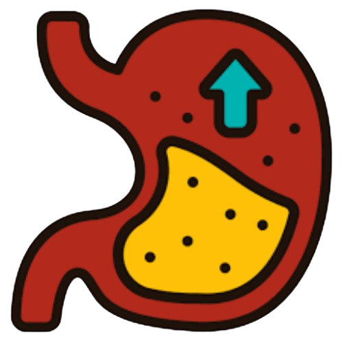 GERD and Acid reflux