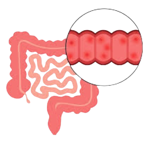 Inflammatory bowel disease