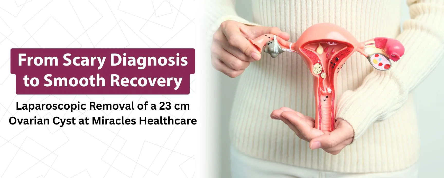 From Scary Diagnosis to Smooth Recovery: Laparoscopic Removal of a 23 cm Ovarian Cyst at Miracles Healthcare